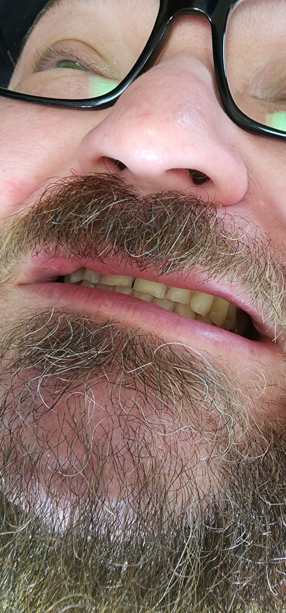 Before