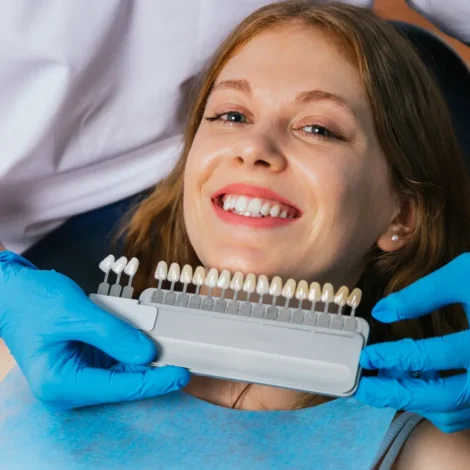 Porcelain-Tooth-Veneers