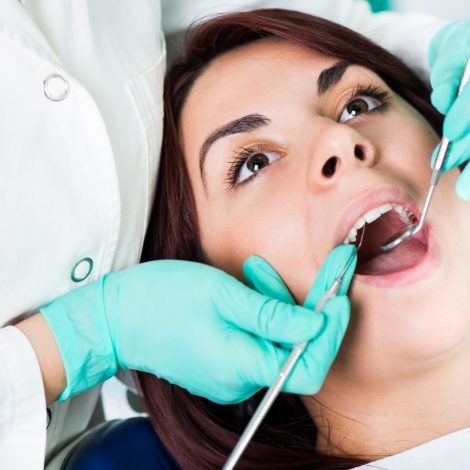 Removal-of-Tartar-and-Plaque